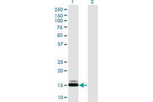 Western Blot analysis of SUMO1 expression in transfected 293T cell line by SUMO1 monoclonal antibody (M03), clone 3D7. (SUMO1 antibody  (AA 1-101))