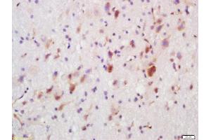 Formalin-fixed and paraffin embedded rat brain labeled with Rabbit Anti-FUT8 Polyclonal Antibody, Unconjugated  at 1:200 followed by conjugation to the secondary antibody and DAB staining (FUT8 antibody  (AA 311-410))