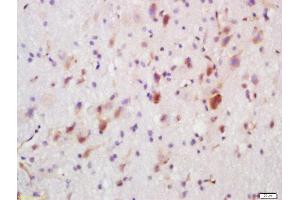 Formalin-fixed and paraffin embedded rat brain labeled with Rabbit Anti-FUT8 Polyclonal Antibody, Unconjugated  at 1:200 followed by conjugation to the secondary antibody and DAB staining