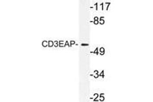 Western blot (WB) analysis of CD3EAP antibody in extracts from A549 cells. (CD3EAP antibody)