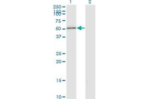 Western Blot analysis of STAU2 expression in transfected 293T cell line by STAU2 monoclonal antibody (M14), clone 3B7. (Double-stranded RNA-binding protein Staufen homolog 2 (STAU2) (AA 341-440) antibody)