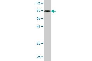 Western Blot detection against Immunogen (87. (CCT8L2 antibody  (AA 1-557))