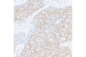 Immunohistochemistry (IHC) image for anti-Mediator Complex Subunit 1 (MED1) (AA 1550-1581) antibody (ABIN7455140) (Recombinant MED1 antibody  (AA 1550-1581))