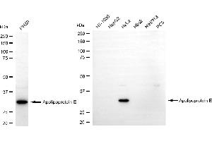 Western blotting analysis using apolipoprotein E antibody (ABIN7797629).