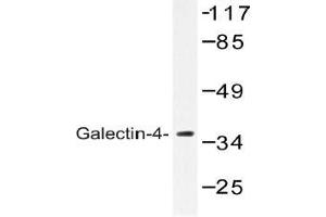 Western blot (WB) analysis of Galectin-4 antibody in extracts from COLO cells.
