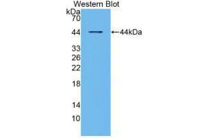 Western blot analysis of recombinant Human RANk. (TNFRSF11A antibody  (AA 330-615))