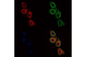 ABIN6259101 and ABIN6275839 staining HepG2 cells by IF/ICC. (MATK antibody  (Internal Region))