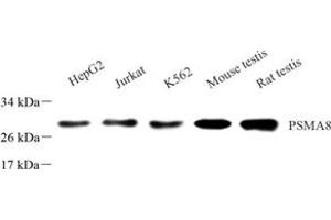 Western blot analysis of PSMA8 (ABIN7075232),at dilution of 1: 1000 (PSMA8 antibody)