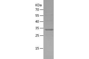 Western Blotting (WB) image for Synaptojanin 2 Binding Protein (SYNJ2BP) (AA 1-117) protein (His-IF2DI Tag) (ABIN7283881) (SYNJ2BP Protein (AA 1-117) (His-IF2DI Tag))