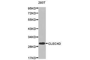 Western Blotting (WB) image for anti-C-Type Lectin Domain Family 4, Member D (CLEC4D) antibody (ABIN1871910) (CLEC4D antibody)