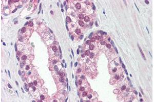 Human Prostate (formalin-fixed, paraffin-embedded) stained with REXO1 antibody ABIN364336 at 5 ug/ml followed by biotinylated anti-mouse IgG secondary antibody ABIN481714, alkaline phosphatase-streptavidin and chromogen. (REXO1 antibody  (AA 1060-1221))