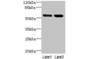 Western blot All lanes: EFCAB14 antibody at 4 μg/mL Lane 1: Colo320 whole cell lysate Lane 2: Hela whole cell lysate Secondary Goat polyclonal to rabbit IgG at 1/10000 dilution Predicted band size: 56 kDa Observed band size: 56 kDa (KIAA0494 antibody  (AA 1-483))