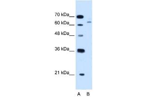 CBS antibody used at 1.