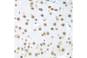 Immunohistochemistry of paraffin-embedded mouse brain using BCAS2 antibody (ABIN5972469) at dilution of 1/100 (40x lens). (BCAS2 antibody)