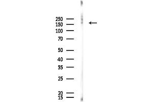 anti-ATP-Binding Cassette, Sub-Family C (CFTR/MRP), Member 2 (ABCC2) (Internal Region) antibody