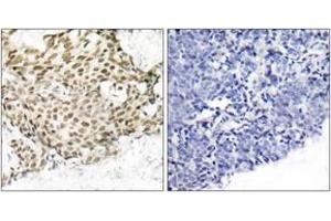 Immunohistochemistry (IHC) image for anti-Nibrin (NBN) (AA 310-359) antibody (ABIN2889031) (Nibrin antibody  (AA 310-359))