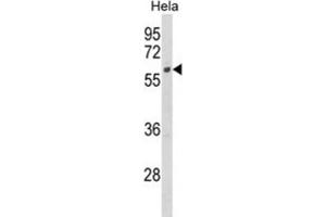 Western Blotting (WB) image for anti-Cytochrome P450, Family 7, Subfamily B, Polypeptide 1 (CYP7B1) antibody (ABIN3003910) (CYP7B1 antibody)