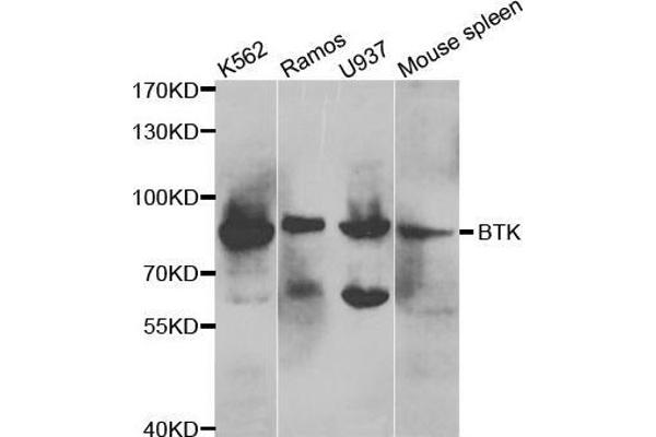 BTK antibody  (AA 30-240)