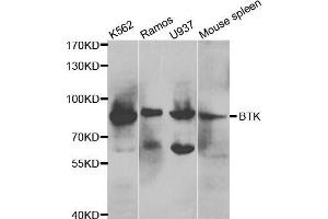 Western blot analysis of extracts of various cell lines, using BTK antibody. (BTK antibody  (AA 30-240))