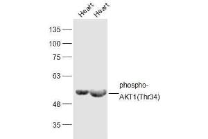 Lane 1: Mouse Heart lysates Lane 2: Rat Heart lysates probed with phospho-AKT1(Thr34) Polyclonal Antibody, Unconjugated  at 1:300 dilution and 4˚C overnight incubation. (AKT1 antibody  (pThr34))