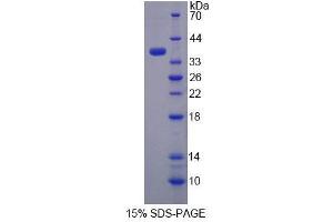 SDS-PAGE (SDS) image for Thiosulfate Sulfurtransferase (Rhodanese) (TST) (AA 2-297) protein (His tag) (ABIN6239479)