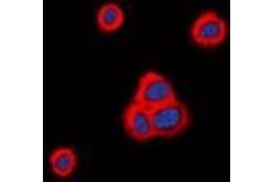 Immunofluorescent analysis of Cadherin 20 staining in HeLa cells. (Cadherin 20 antibody)