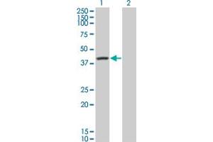 Western Blot analysis of SERPINA6 expression in transfected 293T cell line by SERPINA6 monoclonal antibody (M01), clone 1F11. (SERPINA6 antibody  (AA 23-405))