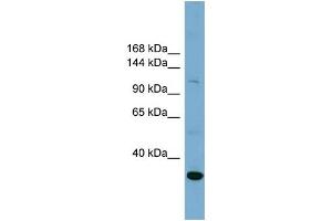 WB Suggested Anti-SLC9A1  Antibody Titration: 0. (SLC9A1 antibody  (Middle Region))