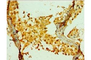 Immunohistochemistry of paraffin-embedded human testis tissue using ABIN7142036 at dilution of 1:100 (PIKFYVE antibody  (AA 1819-2098))