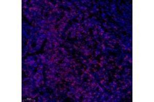 Immunofluorescence of paraffin embedded human tonsil using CD3 (ABIN7073386) at dilution of 1: 500 (200x lens) (CD3 antibody)