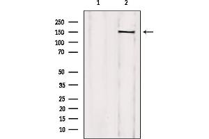 TCOF1 antibody  (N-Term)
