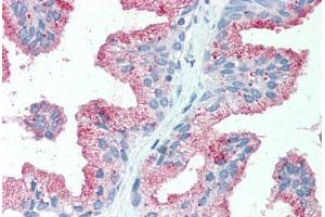 Anti-SLC39A14 antibody  ABIN1049336 IHC staining of human prostate. (SLC39A14 antibody  (Internal Region))