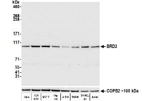 Western Blotting (WB) image for anti-Bromodomain Containing 2 (BRD2) (AA 700-750) antibody (ABIN7795619)