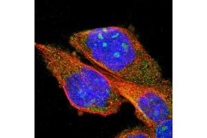 Immunofluorescent staining of human cell line A-431 shows positivity in nucleoli & cytoplasm. (PPM1B antibody  (AA 359-463))