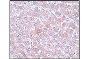 Immunohistochemistry of RSRC1 in rat liver tissue with this product at 5 μg/ml. (RSRC1 antibody  (C-Term))