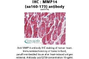 Image no. 4 for anti-Matrix Metallopeptidase 14 (Membrane-inserted) (MMP14) (AA 160-173) antibody (ABIN2852383) (MMP14 antibody  (AA 160-173))