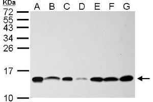 WB Image NHP2L1 antibody detects NHP2L1 protein by Western blot analysis. (NHP2L1 antibody  (full length))
