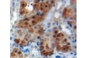 Used in DAB staining on fromalin fixed paraffin-embedded Kidney tissue (PSMC2 antibody  (AA 1-433))