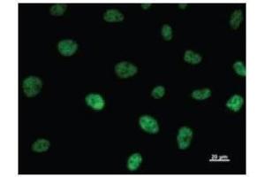 Immunostaining analysis in HeLa cells. (TAF6 antibody)