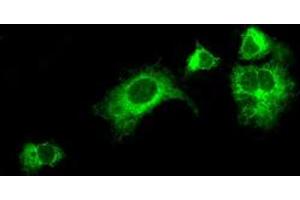 Image no. 2 for anti-Lysyl Oxidase (LOX) (AA 22-168) antibody (ABIN1491219)