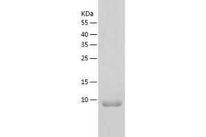 Western Blotting (WB) image for Small Ubiquitin Related Modifier Protein 1 (SUMO1) (AA 1-102) protein (His tag) (ABIN7286376) (SUMO1 Protein (AA 1-102) (His tag))