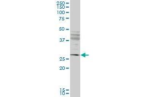 IFT57 monoclonal antibody (M02), clone 1G8. (IFT57 antibody  (AA 214-312))