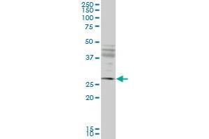 IFT57 monoclonal antibody (M02), clone 1G8.