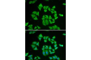 Immunofluorescence analysis of A549 cells using GSTM2 antibody. (GSTM2 antibody)