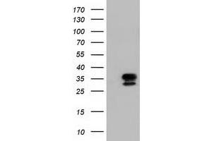 HEK293T cells were transfected with the pCMV6-ENTRY control (Left lane) or pCMV6-ENTRY NSMCE2 (Right lane) cDNA for 48 hrs and lysed. (NSMCE2 antibody)