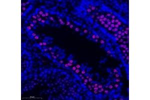 Immunofluorescent analysis of paraformaldehyde-fixed mouse testis using CNOT8 (ABIN7073363) at dilution of 1: 800 (CNOT8 antibody)