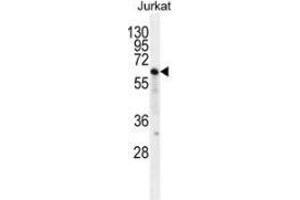 Western blot analysis in Jurkat cell line lysates (35ug/lane) using NKD2  Antibody (C-term). (NKD2 antibody  (C-Term))