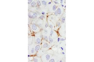 Immunohistochemistry (IHC) image for anti-Receptor tyrosine-protein kinase erbB-2 (ErbB2/Her2) (AA 1200-1250) antibody (ABIN7453853)