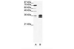 Image no. 1 for anti-Nuclear Factor-kB p65 (NFkBP65) (AA 21-70) antibody (ABIN203274) (NF-kB p65 antibody  (AA 21-70))