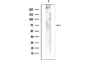Western blot analysis of lysates from Rat testis, using AIFL Mouse Monoclonal Antibody at 1/1000 dilution.